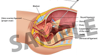 3D-Medical-Illustration-Sample
